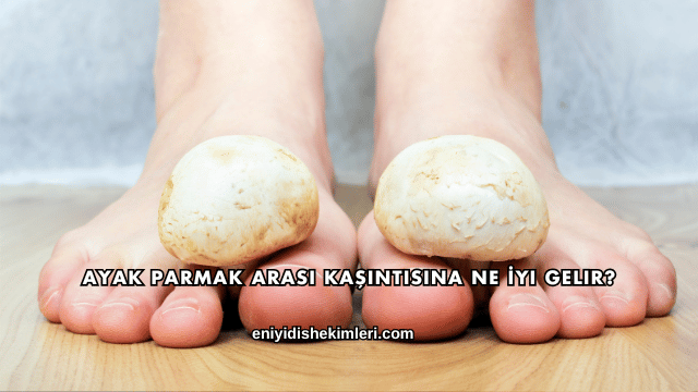 Ayak Parmak Arası Kaşıntısına Ne İyi Gelir?