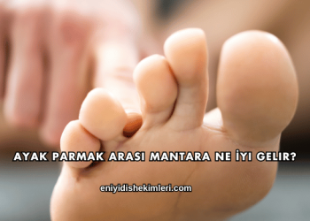 Ayak Parmak Arası Mantara Ne İyi Gelir?