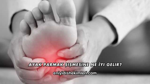 Ayak Parmak Şişmesine Ne İyi Gelir?