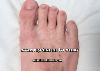 Ayak Pişiğine Ne İyi Gelir?