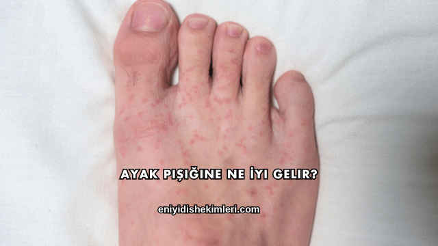 Ayak Pişiğine Ne İyi Gelir?