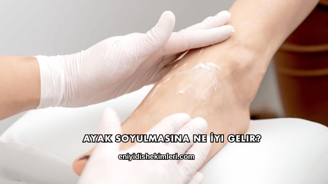Ayak Soyulmasına Ne İyi Gelir?