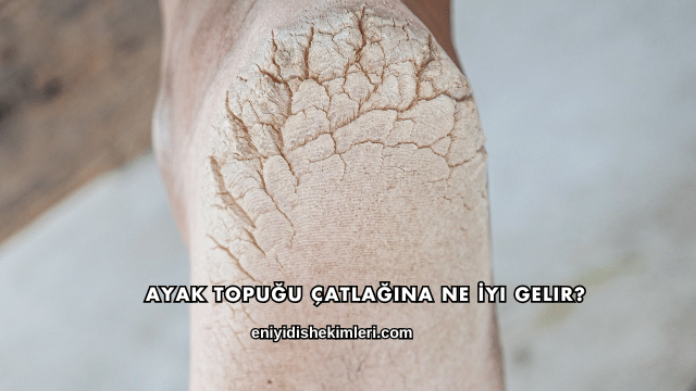 Ayak Topuğu Çatlağına Ne İyi Gelir?