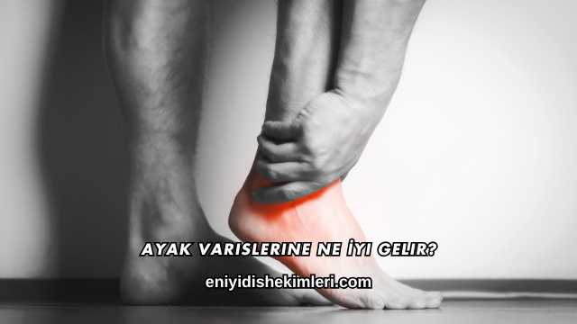 Ayak Varislerine Ne İyi Gelir?