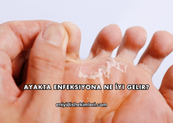 Ayakta Enfeksiyona Ne İyi Gelir?