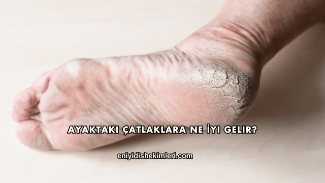 Ayaktaki Çatlaklara Ne İyi Gelir?