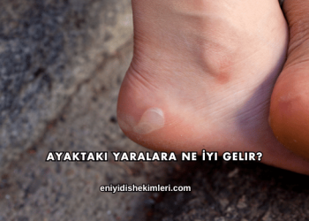 Ayaktaki Yaralara Ne İyi Gelir?