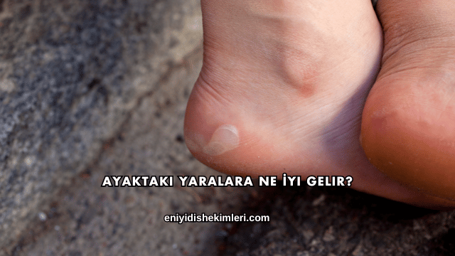 Ayaktaki Yaralara Ne İyi Gelir?