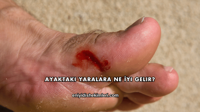Ayaktaki Yaralara Ne İyi Gelir?