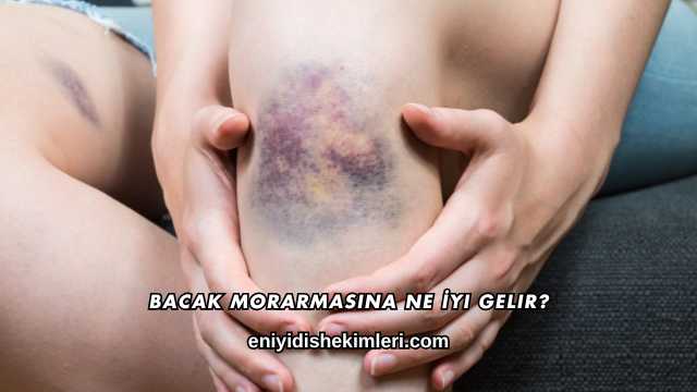 Bacak Morarmasına Ne İyi Gelir?