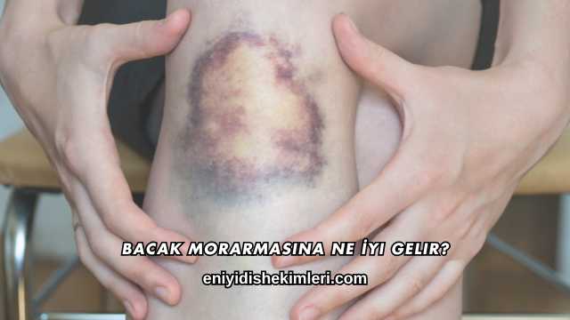 Bacak Morarmasına Ne İyi Gelir?