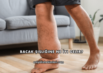 Bacak Şişliğine Ne İyi Gelir?