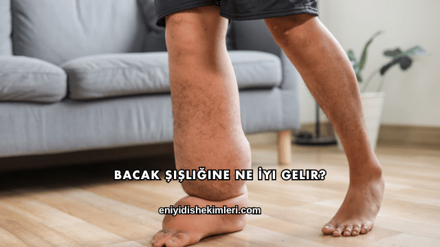 Bacak Şişliğine Ne İyi Gelir?