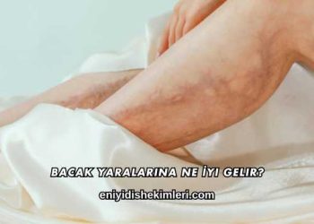 Bacak Yaralarına Ne İyi Gelir?