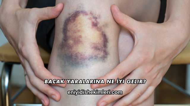 Bacak Yaralarına Ne İyi Gelir?