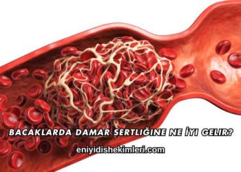 Bacaklarda Damar Sertliğine Ne İyi Gelir?