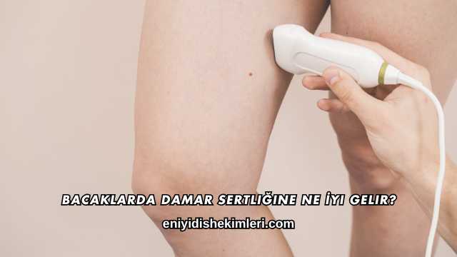 Bacaklarda Damar Sertliğine Ne İyi Gelir?