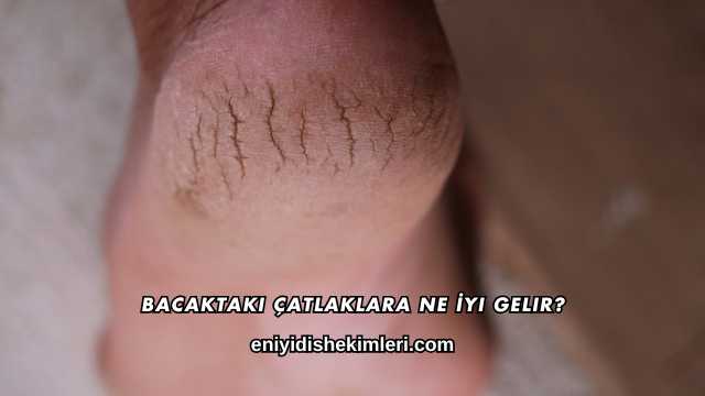 Bacaktaki Çatlaklara Ne İyi Gelir?