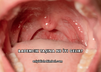 Bademcik Taşına Ne İyi Gelir?