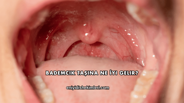 Bademcik Taşına Ne İyi Gelir?