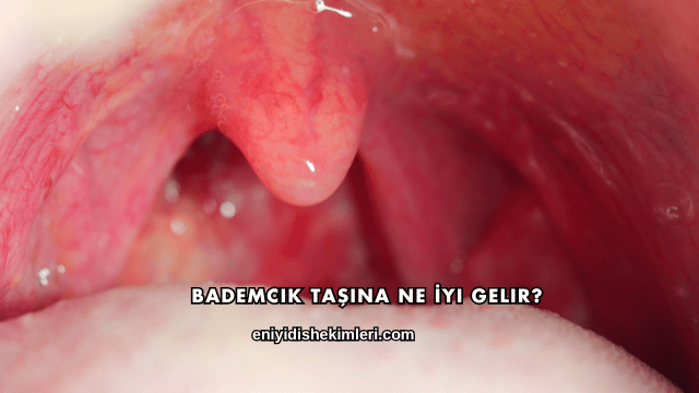 Bademcik Taşına Ne İyi Gelir?