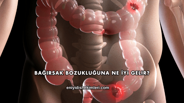 Bağırsak Bozukluğuna Ne İyi Gelir?