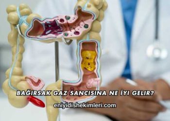 Bağırsak Gaz Sancısına Ne İyi Gelir?