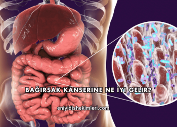 Bağırsak Kanserine Ne İyi Gelir?