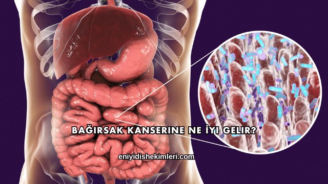 Bağırsak Kanserine Ne İyi Gelir?
