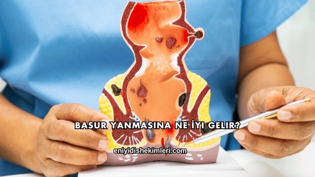 Basur Yanmasına Ne İyi Gelir?