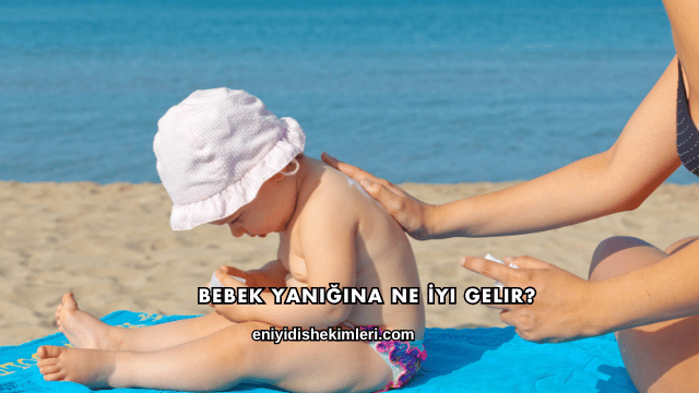Bebek Yanığına Ne İyi Gelir?