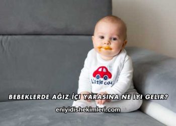 Bebeklerde Ağız İçi Yarasına Ne İyi Gelir?