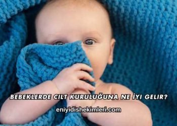 Bebeklerde Cilt Kuruluğuna Ne İyi Gelir?
