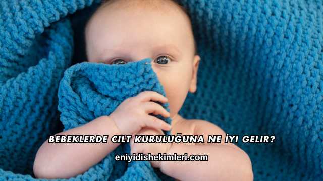 Bebeklerde Cilt Kuruluğuna Ne İyi Gelir?
