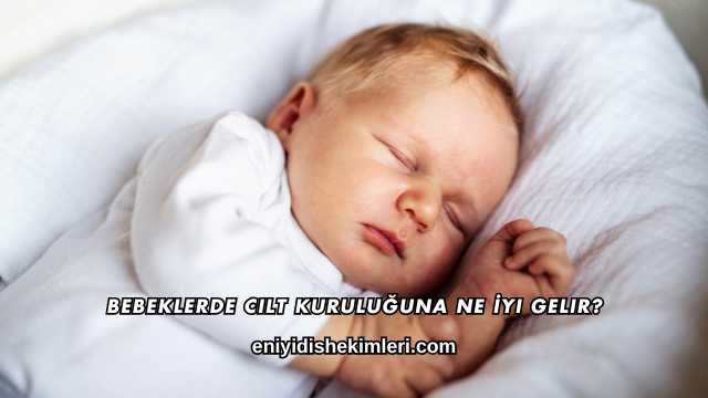 Bebeklerde Cilt Kuruluğuna Ne İyi Gelir?