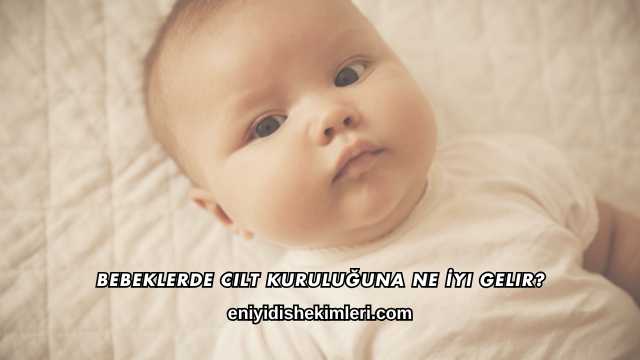 Bebeklerde Cilt Kuruluğuna Ne İyi Gelir?
