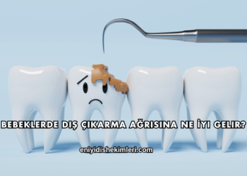 Bebeklerde Diş Çıkarma Ağrısına Ne İyi Gelir?