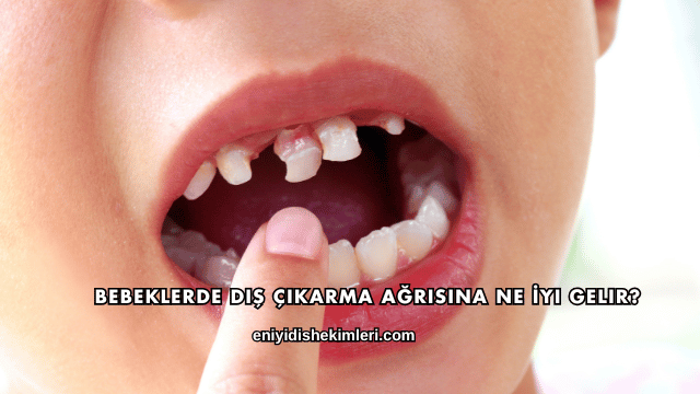 Bebeklerde Diş Çıkarma Ağrısına Ne İyi Gelir?