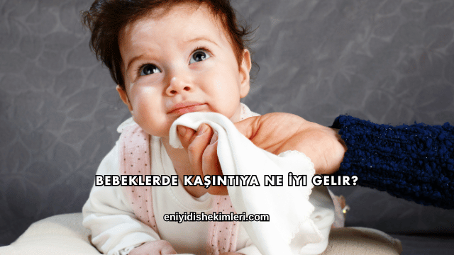 Bebeklerde Kaşıntıya Ne İyi Gelir?