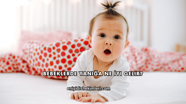 Bebeklerde Yanığa Ne İyi Gelir?