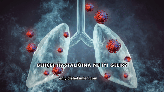 Behçet Hastalığına Ne İyi Gelir?