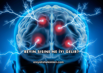 Beyin Sisine Ne İyi Gelir?