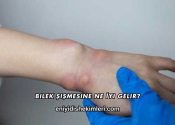 Bilek Şişmesine Ne İyi Gelir?