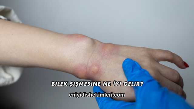 Bilek Şişmesine Ne İyi Gelir?