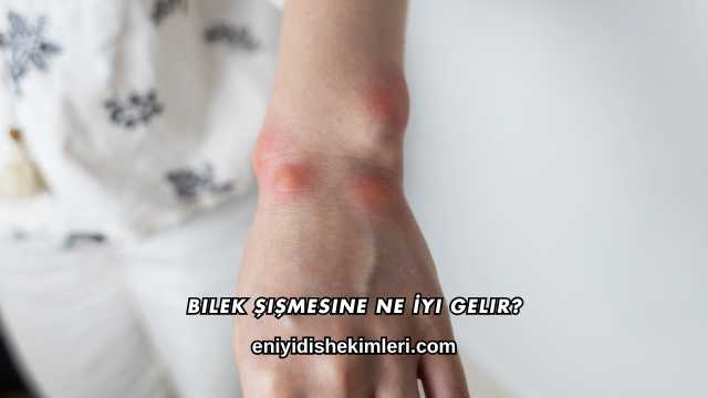 Bilek Şişmesine Ne İyi Gelir?