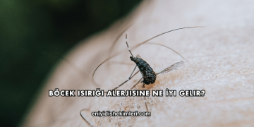 Böcek Isırığı Alerjisine Ne İyi Gelir?