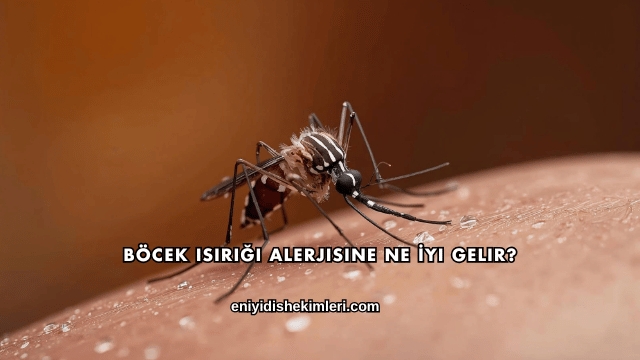Böcek Isırığı Alerjisine Ne İyi Gelir?