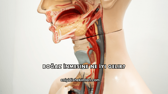 Boğaz İnmesine Ne İyi Gelir?