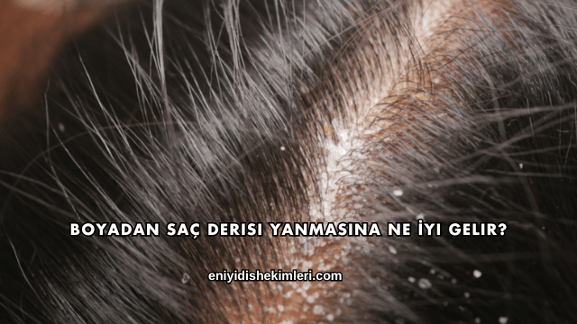 Boyadan Saç Derisi Yanmasına Ne İyi Gelir?