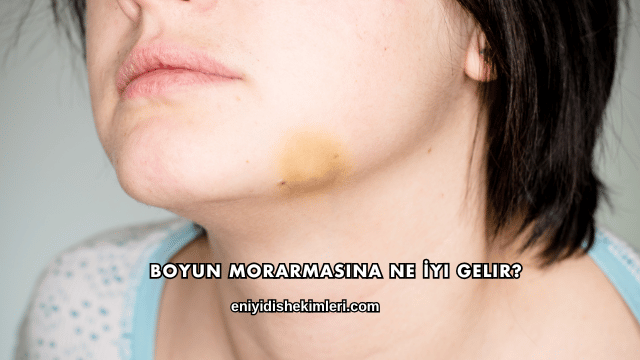 Boyun Morarmasına Ne İyi Gelir?